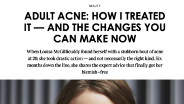 The Times – acne